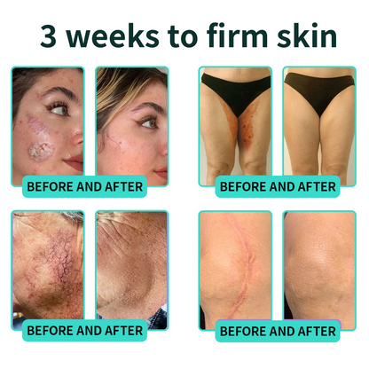 Authorized Flagship Store ✨|🌥️𝑽𝒊𝒕𝒂𝒍𝒊𝒔𝒚𝒔 𝑷𝑫𝑹𝑵 𝑪𝒂𝒑𝒔𝒖𝒍𝒆 𝑪𝒓𝒆𝒂𝒎 100|Anti aging, firming and lifting muscles Skin care, removal of stretch marks, breast enhancement, removal of chest lines, and skin repair.