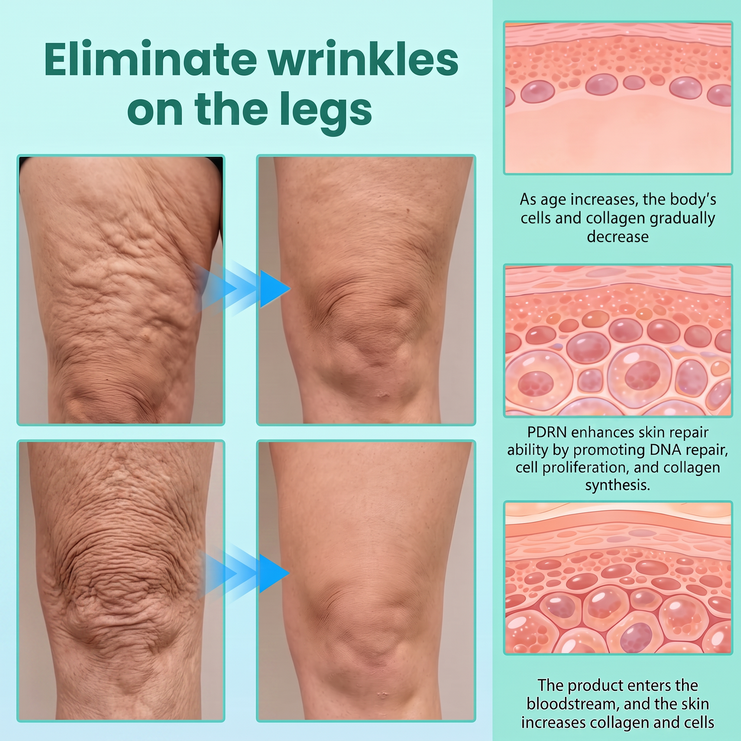 Authorized Flagship Store ✨|🌥️𝑽𝒊𝒕𝒂𝒍𝒊𝒔𝒚𝒔 𝑷𝑫𝑹𝑵 𝑪𝒂𝒑𝒔𝒖𝒍𝒆 𝑪𝒓𝒆𝒂𝒎 100|Anti aging, firming and lifting muscles Skin care, removal of stretch marks, breast enhancement, removal of chest lines, and skin repair.