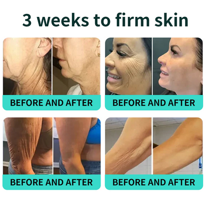 Authorized Flagship Store ✨|🌥️𝑽𝒊𝒕𝒂𝒍𝒊𝒔𝒚𝒔 𝑷𝑫𝑹𝑵 𝑪𝒂𝒑𝒔𝒖𝒍𝒆 𝑪𝒓𝒆𝒂𝒎 100|Anti aging, firming and lifting muscles Skin care, removal of stretch marks, breast enhancement, removal of chest lines, and skin repair.