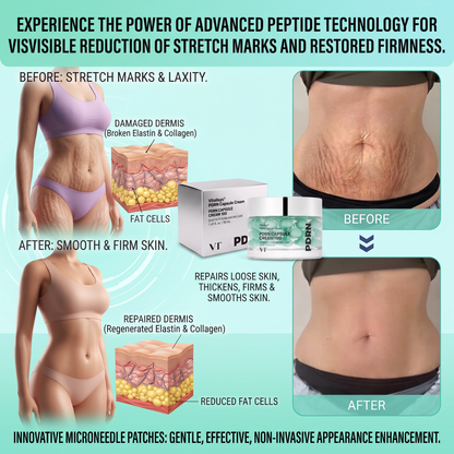Authorized Flagship Store ✨|🌥️𝑽𝒊𝒕𝒂𝒍𝒊𝒔𝒚𝒔 𝑷𝑫𝑹𝑵 𝑪𝒂𝒑𝒔𝒖𝒍𝒆 𝑪𝒓𝒆𝒂𝒎 100|Anti aging, firming and lifting muscles Skin care, removal of stretch marks, breast enhancement, removal of chest lines, and skin repair.