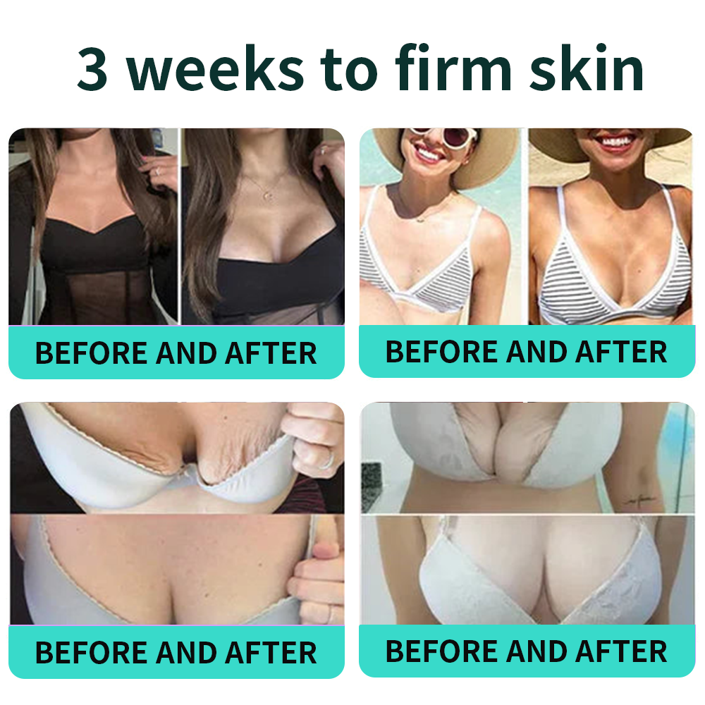 Authorized Flagship Store ✨|🌥️𝑽𝒊𝒕𝒂𝒍𝒊𝒔𝒚𝒔 𝑷𝑫𝑹𝑵 𝑪𝒂𝒑𝒔𝒖𝒍𝒆 𝑪𝒓𝒆𝒂𝒎 100|Anti aging, firming and lifting muscles Skin care, removal of stretch marks, breast enhancement, removal of chest lines, and skin repair.