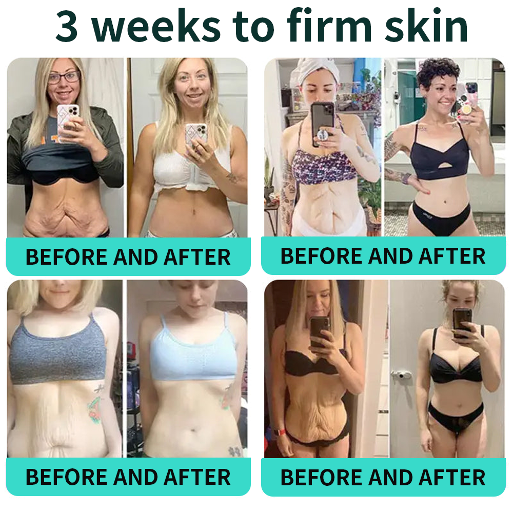 Authorized Flagship Store ✨|🌥️𝑽𝒊𝒕𝒂𝒍𝒊𝒔𝒚𝒔 𝑷𝑫𝑹𝑵 𝑪𝒂𝒑𝒔𝒖𝒍𝒆 𝑪𝒓𝒆𝒂𝒎 100|Anti aging, firming and lifting muscles Skin care, removal of stretch marks, breast enhancement, removal of chest lines, and skin repair.