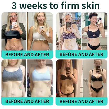Authorized Flagship Store ✨|🌥️𝑽𝒊𝒕𝒂𝒍𝒊𝒔𝒚𝒔 𝑷𝑫𝑹𝑵 𝑪𝒂𝒑𝒔𝒖𝒍𝒆 𝑪𝒓𝒆𝒂𝒎 100|Anti aging, firming and lifting muscles Skin care, removal of stretch marks, breast enhancement, removal of chest lines, and skin repair.